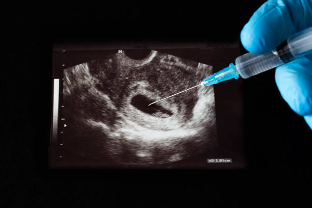 How Much Does An Abortion Cost Without Insurance